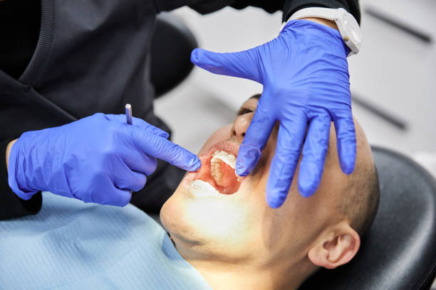 Best Knocked-Out Tooth (Avulsed Tooth) Treatment in Kenhorst, PA